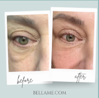 Bellame HYDRATING EYE CREAM