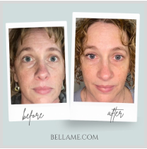 Bellame HYDRATING EYE CREAM